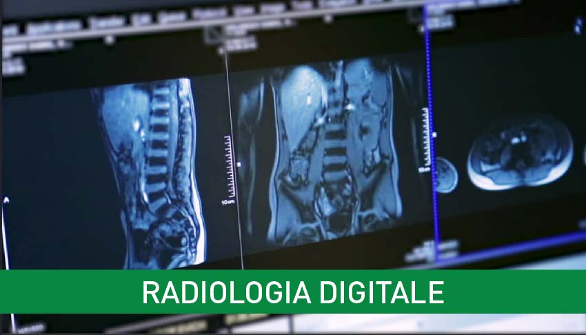 radiologia-digitale-igea-sant-antimo.jpg